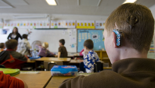 A child with cochlear implants sits apart from the rest of his classmates